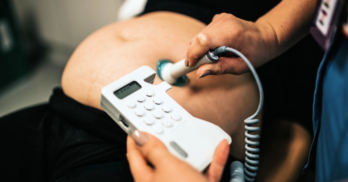 A close-up view shows a healthcare professional applying the probe of a Doppler to a pregnant woman's belly.