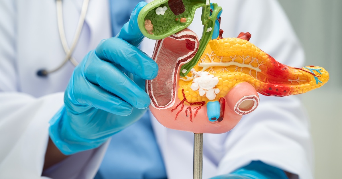 5 Applications for Dopplers in Endocrinology A medical professional in blue gloves holds an anatomical model of the pancreas, gallbladder, and digestive system organs.